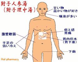 附子人参湯(附子理中丸)