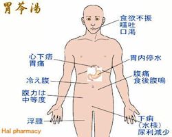 胃苓湯(平胃散+五苓散)