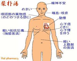 柴朴湯(小柴胡湯+半夏厚朴湯)