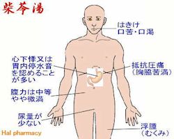 柴苓湯(小柴胡湯+五苓散)